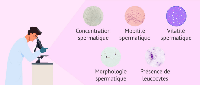 Imagen: Paramètres microscopiques du spermogramme