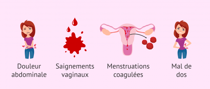 Imagen: Symptômes biochimiques de la grossesse
