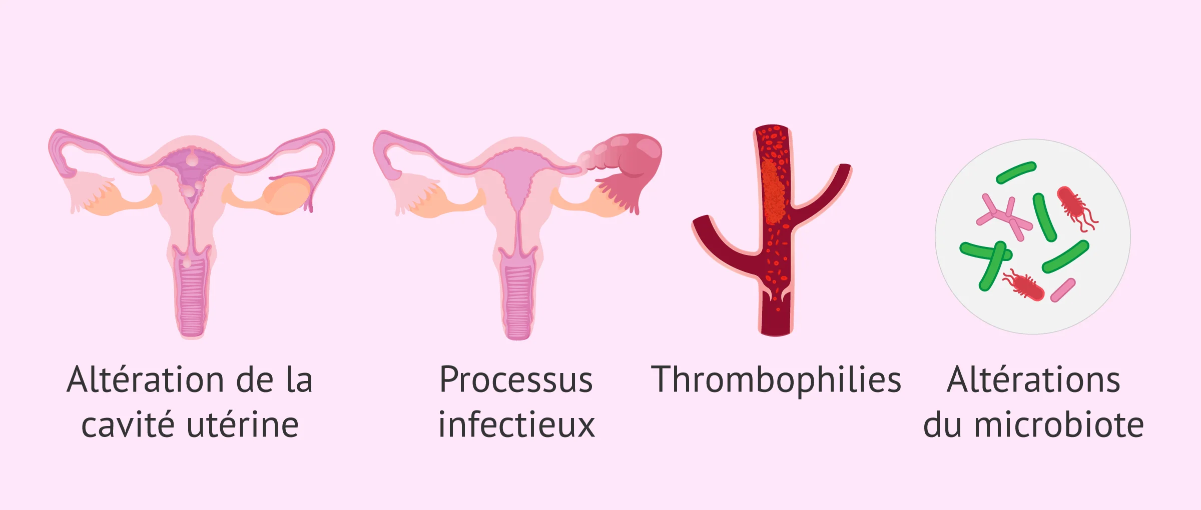 Imagen: Causes d'une faible réceptivité endométriale