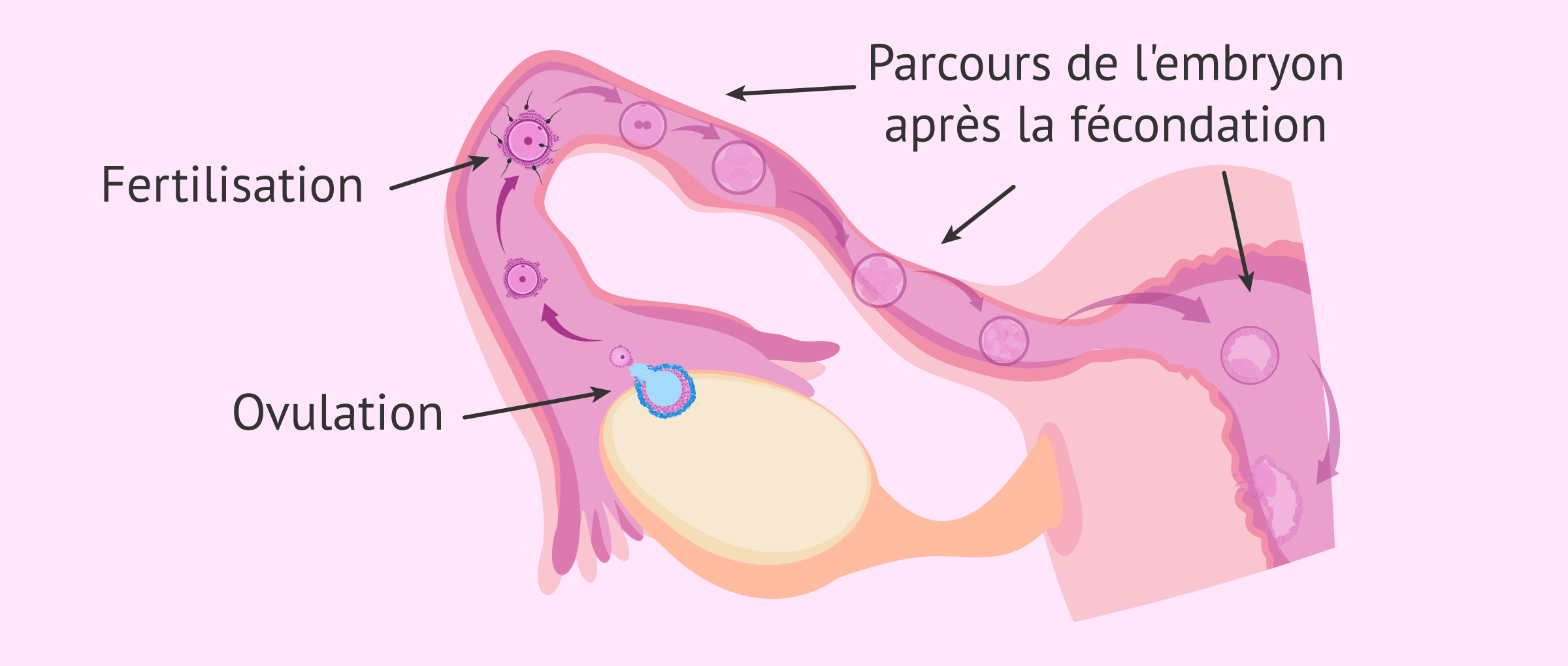 Imagen: Importance des trompes de Fallope