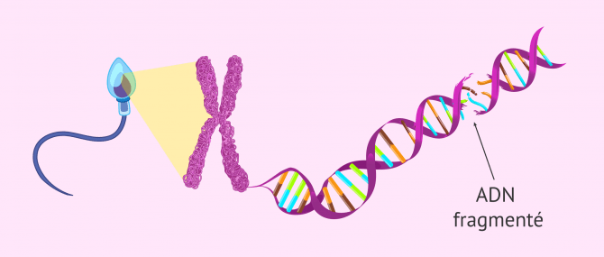 Imagen: Qu'est-ce que la fragmentation de l'ADN du sperme?