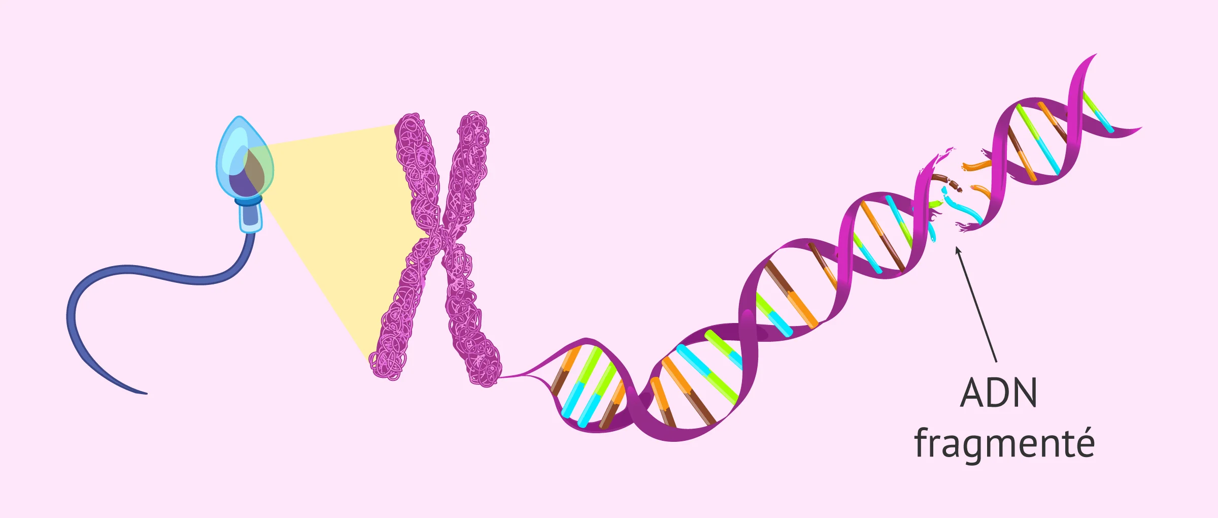 Imagen: Qu'est-ce que la fragmentation de l'ADN du sperme?