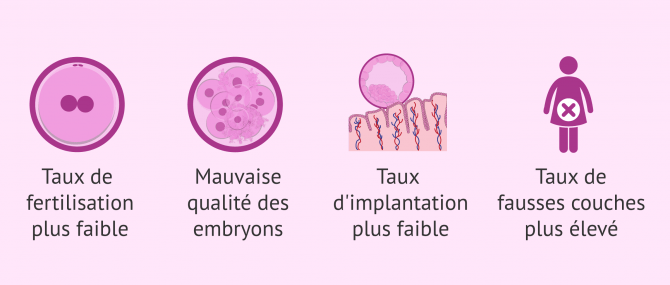 Imagen: Fragmentation de l'ADN des spermatozoïdes et fertilité masculine