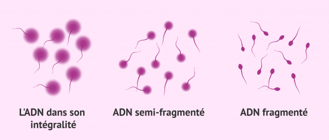 Imagen: Test de dispersion de la chromatine du sperme