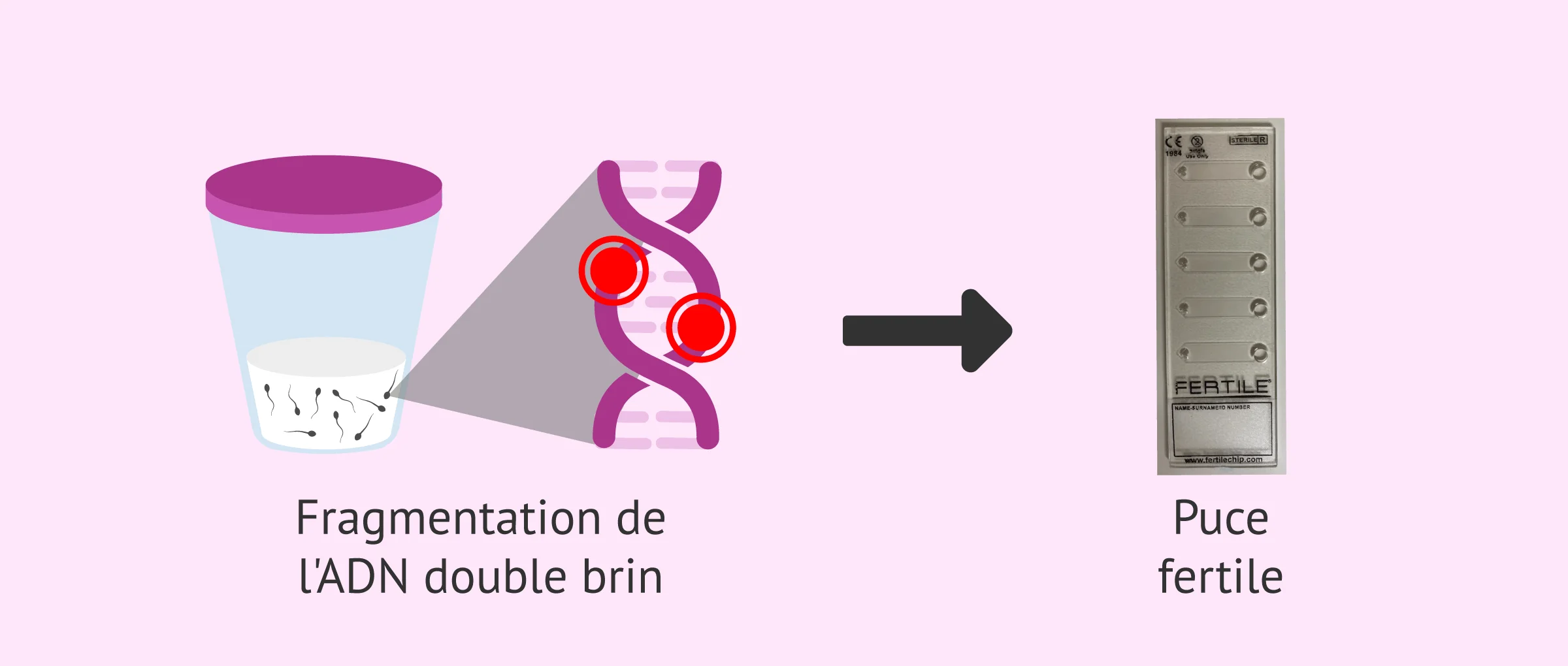 Imagen: Une puce fertile pour la fragmentation de l'ADN des spermatozoïdes