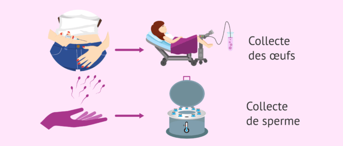 Imagen: Processus de FIV avec don de sperme