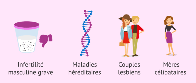 Imagen: Quand a-t-on besoin du sperme d'un donneur?