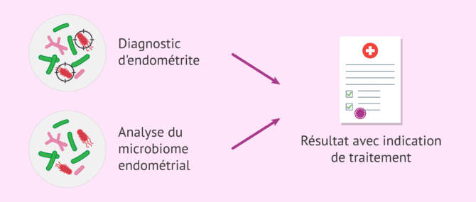 Imagen: Analyse du microbiome endométrial pour favoriser l'implantation