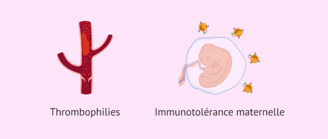 Imagen: Étude des thrombophilies et bilan immunologique dans les échecs d'implantation