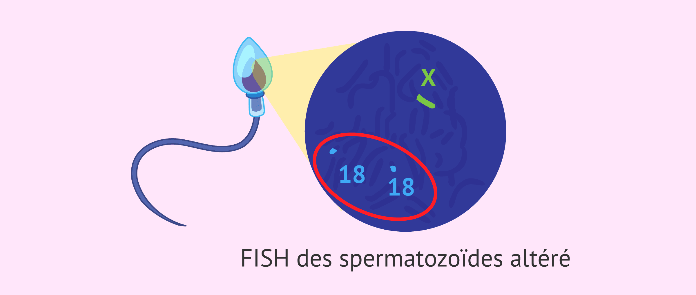 Imagen: FISH des spermatozoïdes altéré