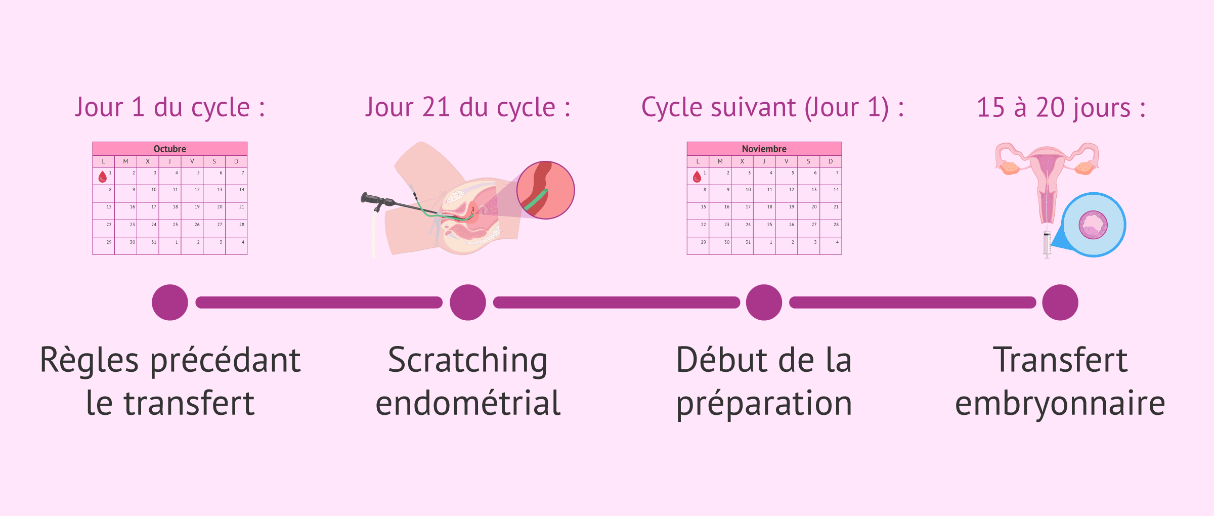 Imagen: Moment opportun pour effectuer el grattage endométrial