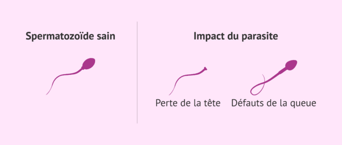 Imagen: Effets de la toxoplasmose sur les spermatozoïdes