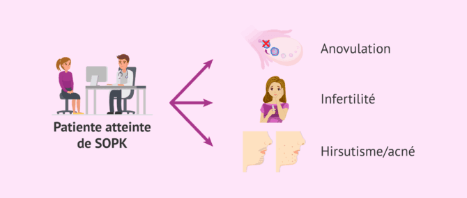 Imagen: Possibles manifestations cliniques du SOPK