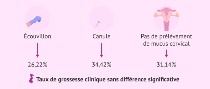 Imagen: Effet du retrait de la glaire cervicale sur le taux de réussite de l'ICSI