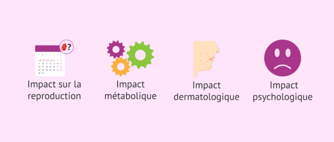 Imagen: Implications du SOPK, désormais connu sous le nom de PMOS