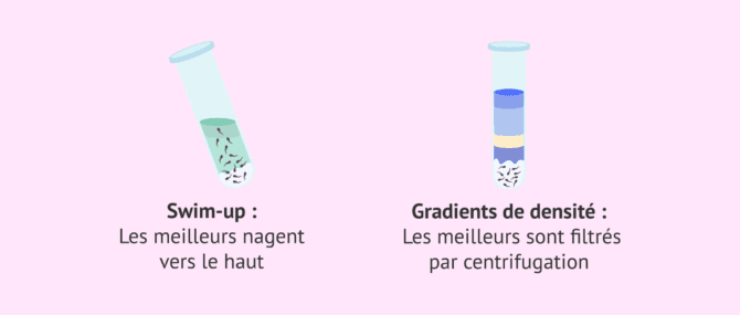 Imagen: Swim-up ou gradients? Quel est le meilleur?