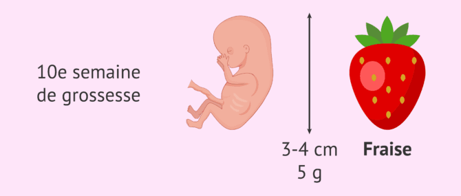Imagen: Mesures du fœtus à 10 semaines de grossesse