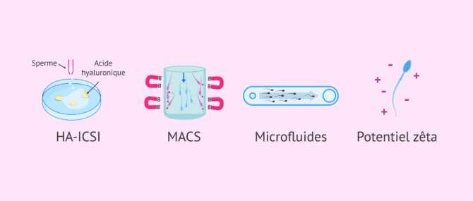 Imagen: Techniques avancées de sélection spermatique