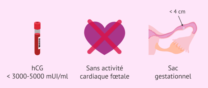 Imagen: Traitement médical de la grossesse ectopique