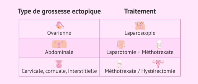 Imagen: Traitement selon le type de grossesse ectopique