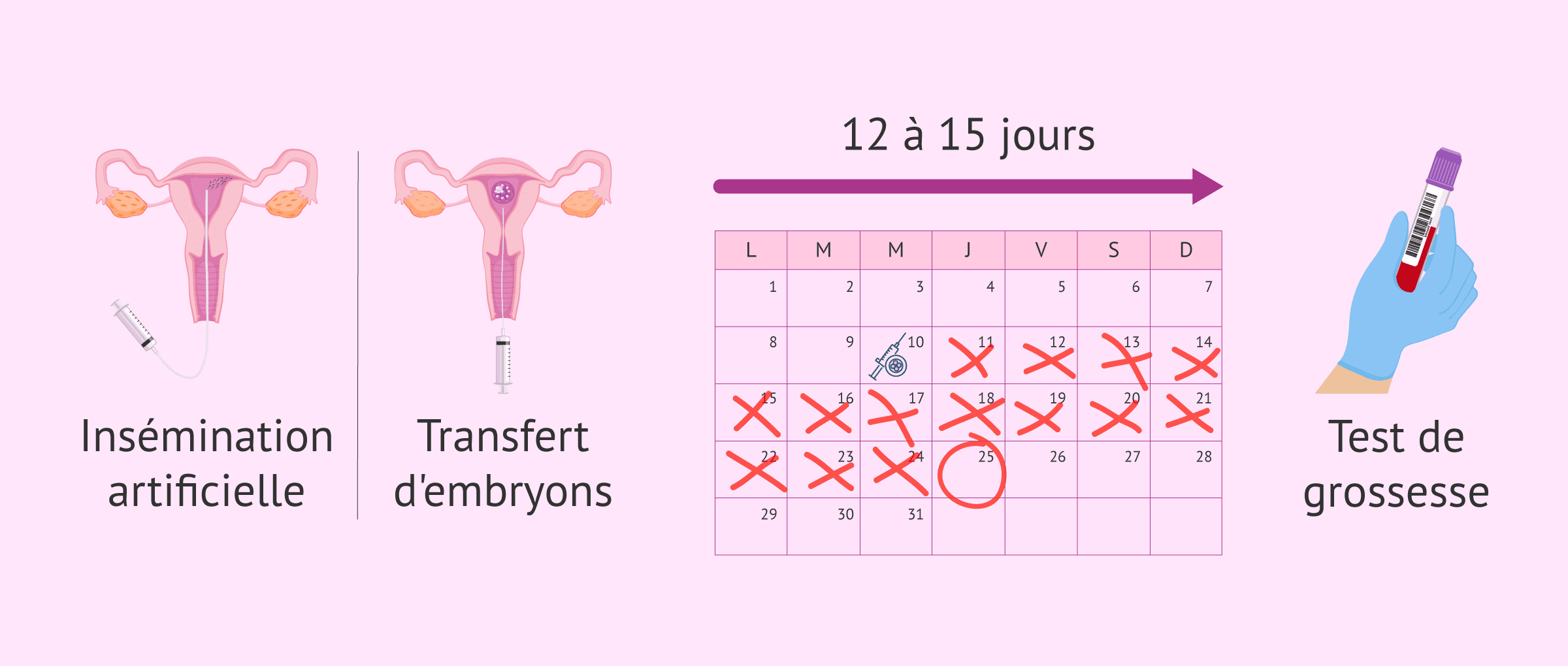 Imagen: Définition de l'attente post-transfert (bêta-attente)